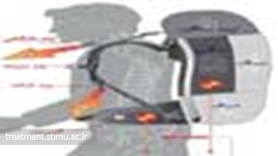 کوله‌پشتی مناسب برای دانش‌آموزان از دیدگاه پزشکان 